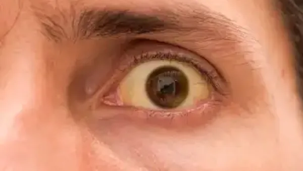 Haber Detayı