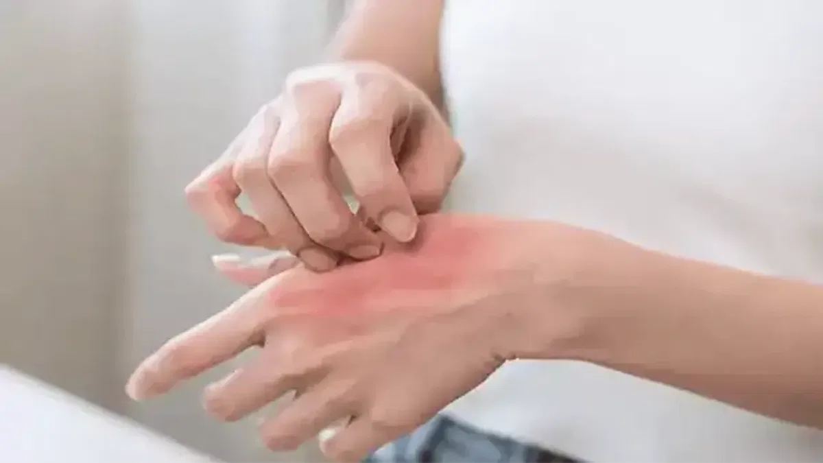 Kaşıntı cilt sorunu değil, duygusal durum