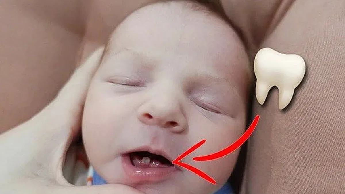 Bebeğiniz Dişli Doğarsa Ne Yapmalısınız? İşte detaylar..