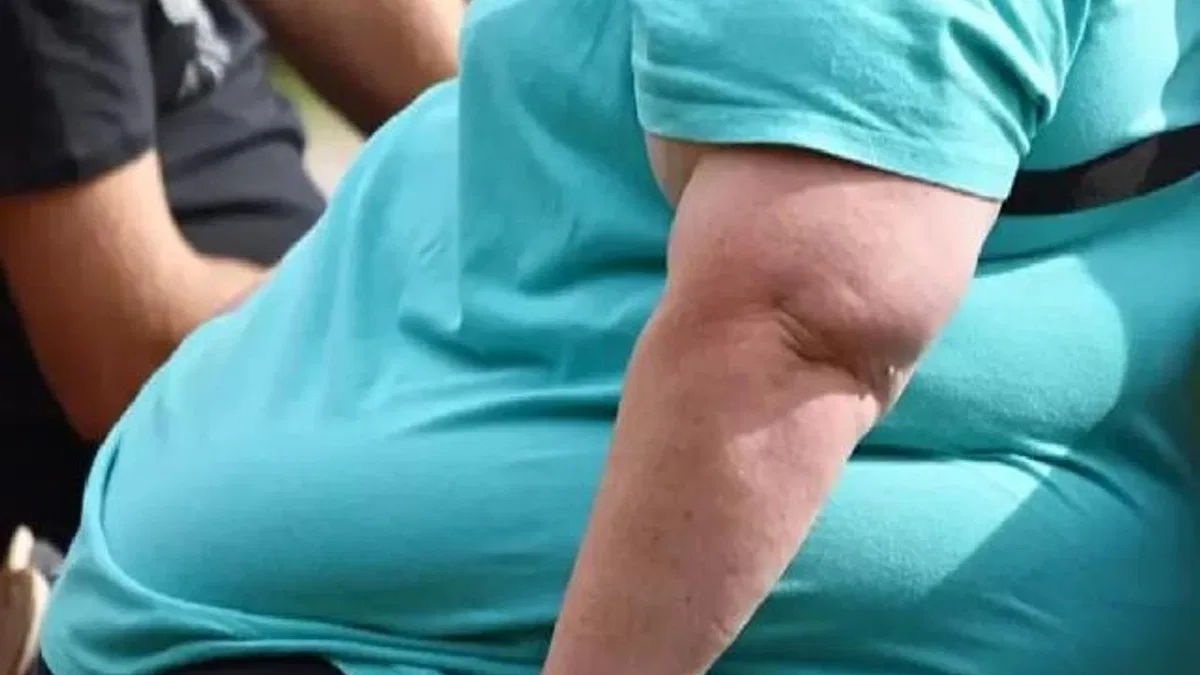 İşte obezitenin tetiklediği ciddi sağlık sorunları