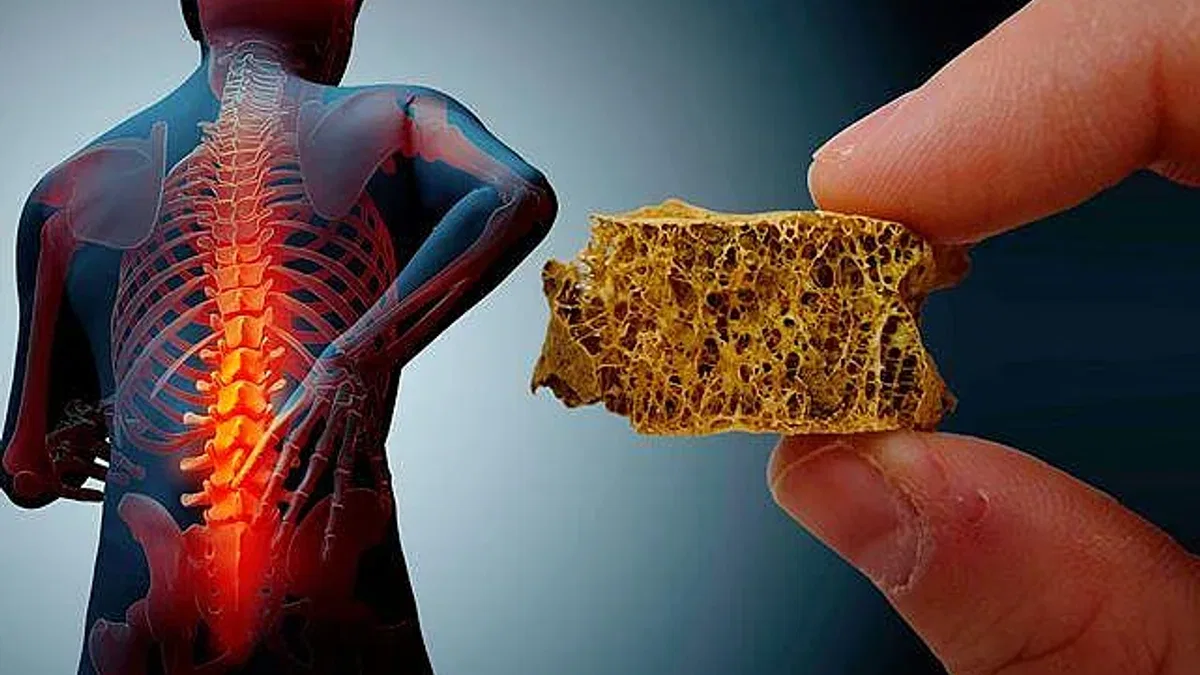 Osteoporozdan Korunmanın Altın Üçlüsü: Beslenme, Güneş ve Hareket