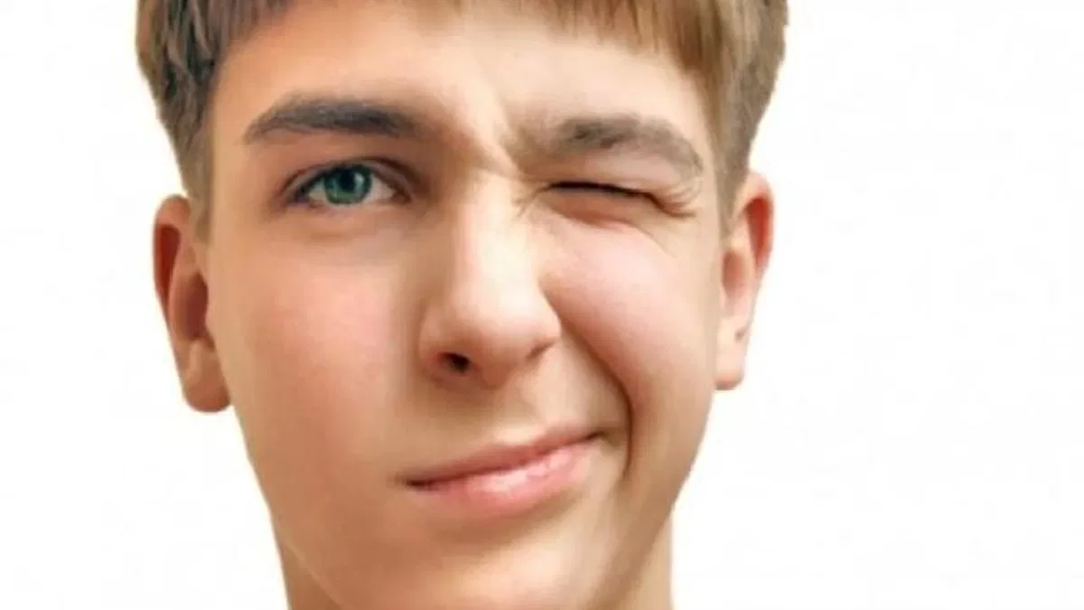 Tourette Sendromu Nedir?